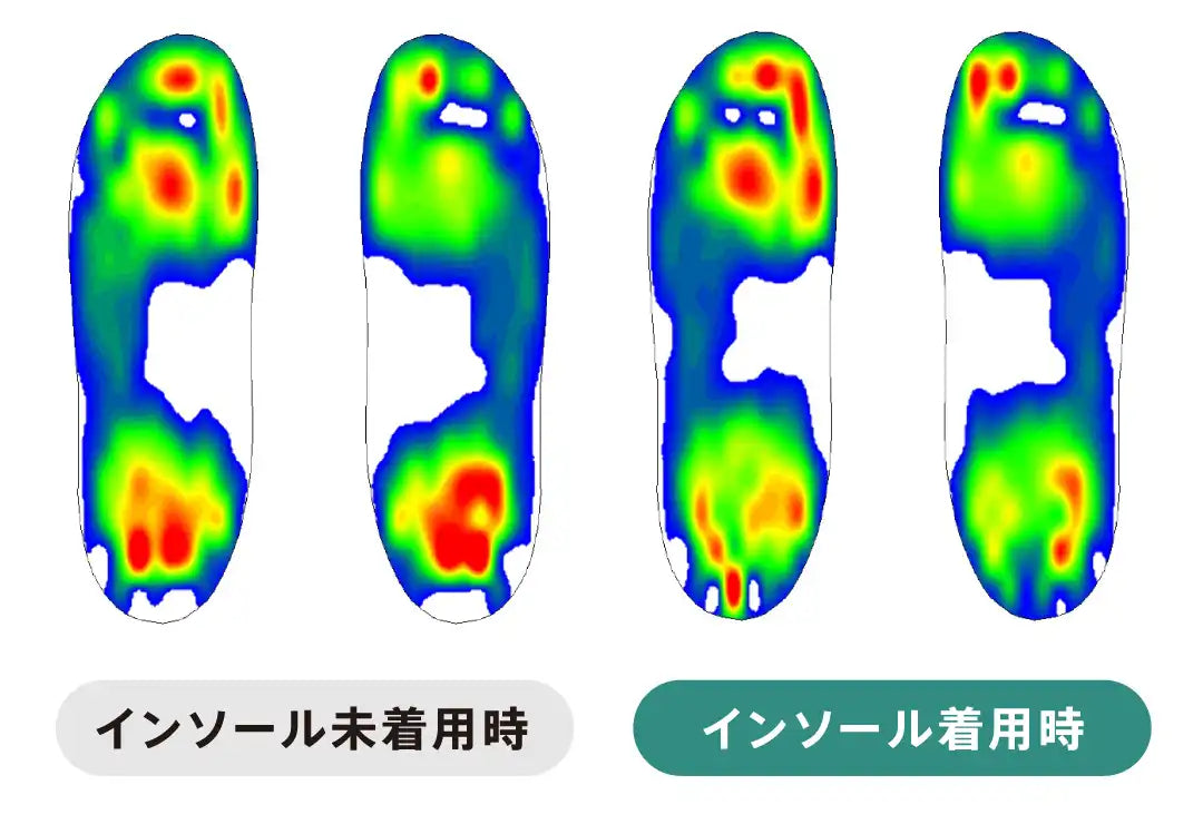 足裏圧力分布の比較（インソール未着用時／着用時）
